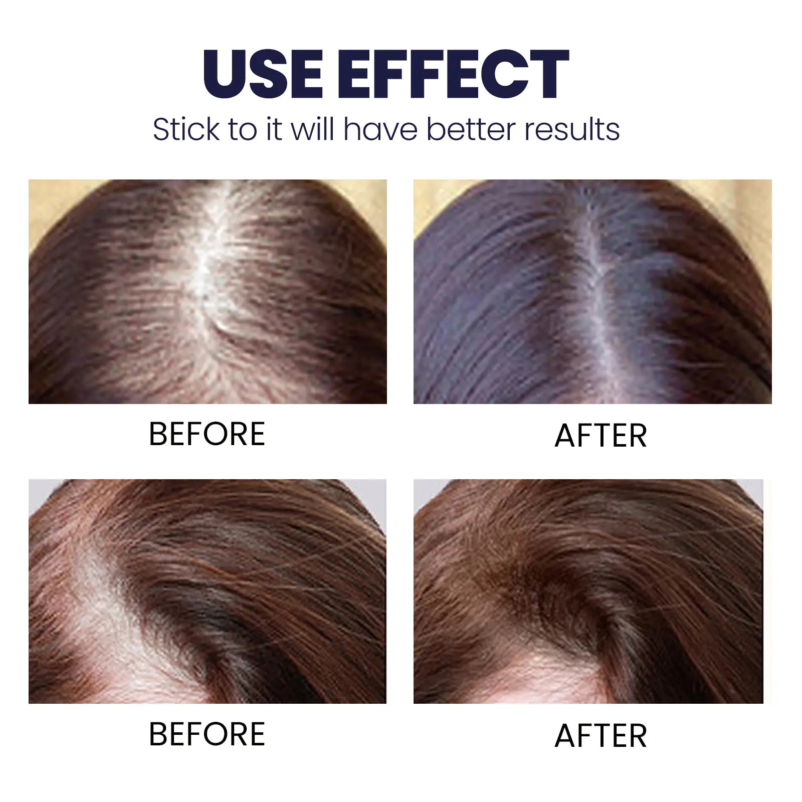 "SERENITY" OUHOE Strong Hold Hair Spray for Damaged Hair Repair